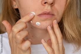 allergic to cosmetics problem skincare