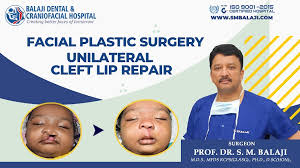 plastic surgery cleft lip and