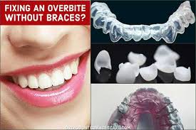 What are the risks associated with orthognathic surgery? How To Fix An Overbite Without Braces Orthodontic Braces Care