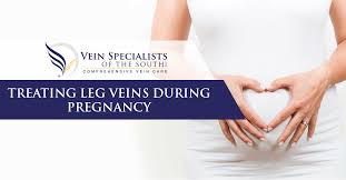 painful leg veins during pregnancy