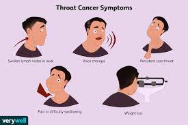 throat cancer signs and symptoms
