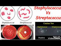 staphylococcus vs streptococcus you