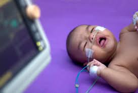 respiratory distress in newborns