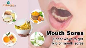 mouth sores causes reasons for