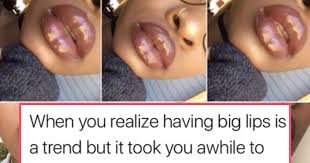 woman s insram post about her lips