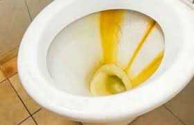 remove yellow stains from toilet bowl