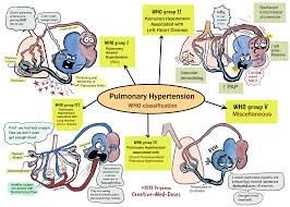 pulmonary hypertension creative med doses