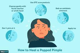 how to heal an open pimple wound fast
