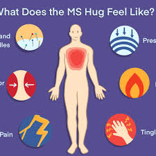 the ms hug symptoms triggers