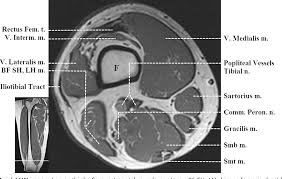 Muscle anatomy of upper thigh, human muscles, muscle anatomy of upper thigh. Figure 6 From Normal Mr Imaging Anatomy Of The Thigh And Leg Semantic Scholar