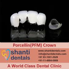 Porcellin Pfm Crown
