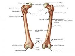 proximal femur fractures presentation