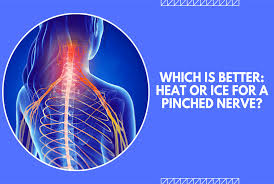 heat or ice for a pinched nerve