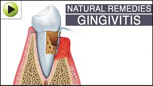 gingivitis natural ayurvedic home