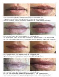 lip rejuvenation and lip plumping with