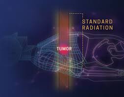 what is proton therapy how does it