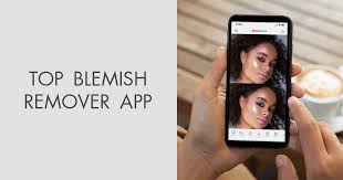 A few clicks later, you will get rid of the unwanted content of your photo. 10 Best Blemish Remover Apps In 2021