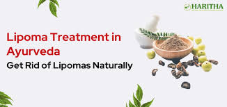 lipoma treatment in ayurveda get rid