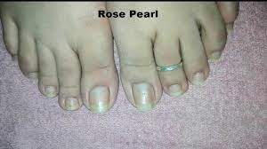 avoid ingrown toe nails