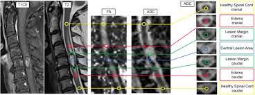 diffusion tensor imaging in unclear