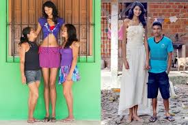 Being tall is an attribute desired by all. Elisany Da Cruz Silva World S Tallest Woman Steemit