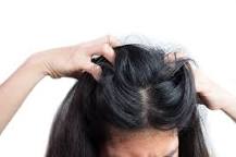 how-do-you-know-if-you-have-a-fungal-infection-on-your-scalp