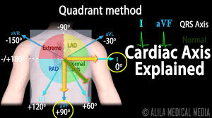 Cardiac Axis Interpretation Animation