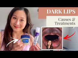 causes and treatments for dark lips