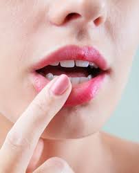 cold sores treatment new jersey