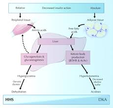 Hyperosmolar Nonketotic Coma Endocrine Medbullets Step 1