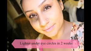 how to lighten dark circles under eyes