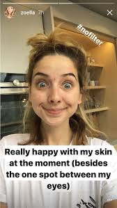 zoella looks gorgeous in totally make