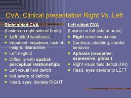 Cva Clinical Presentation Right Vs Left Right H3 Resolution 728 X 546 Px
