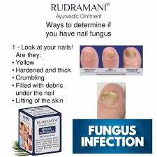 anti fungal nail cream rudramani