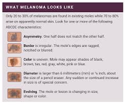 Melanoma is one of the most serious forms of cancer, and because its appearance can closely mimic natural moles, freckles, and age spots, it can be easy to overlook. How To Detect Skin Cancer Roswell Park Comprehensive Cancer Center