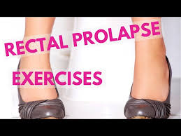 rectal prolapse exercises and bowel