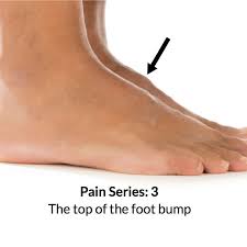The foot ft to centimeter cm conversion table and conversion steps are also listed. Foot Bump On Top Of The Foot Consulting Footpain