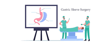 all you need to know about gastric