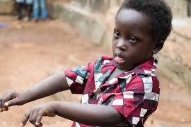 People with the syndrome may also have other health problems. Devil Boy Down S Syndrome In Sierra Leone Health Al Jazeera