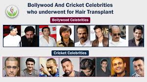 cricket celebrities hair transplant