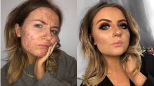 acne makeup tutorial full face of