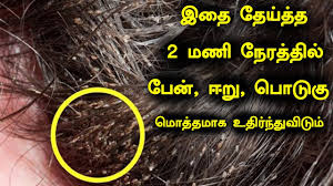 lice removing tips in tamil