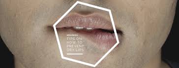 top tips to prevent dry lips