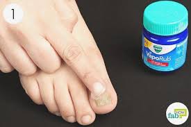 vicks vaporub for toenail fungus