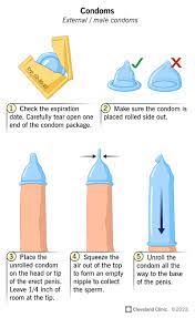 Condoms: Birth Control, Types, How They Work & Effectiveness