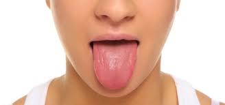 red spots on tongue causes symptoms