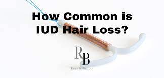 iud hair loss iud symptoms houston