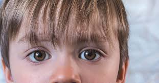 pink eye in toddlers identification