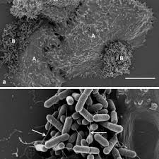 Listeria monocytogenes is a ubiquitous microorganism responsible for listeriosis, a rare but severe disease in humans, who can become infected by ingesting contaminated food products, namely dairy. Scanning Electron Microscopy Images Of Listeria Monocytogenes Download Scientific Diagram