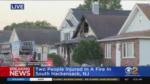 2 hurt in south hackensack fire you